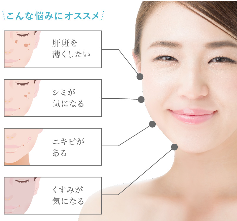 シミ・美白・ニキビのお悩み