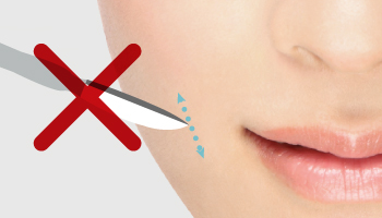 シミ・美白・ニキビのお悩み